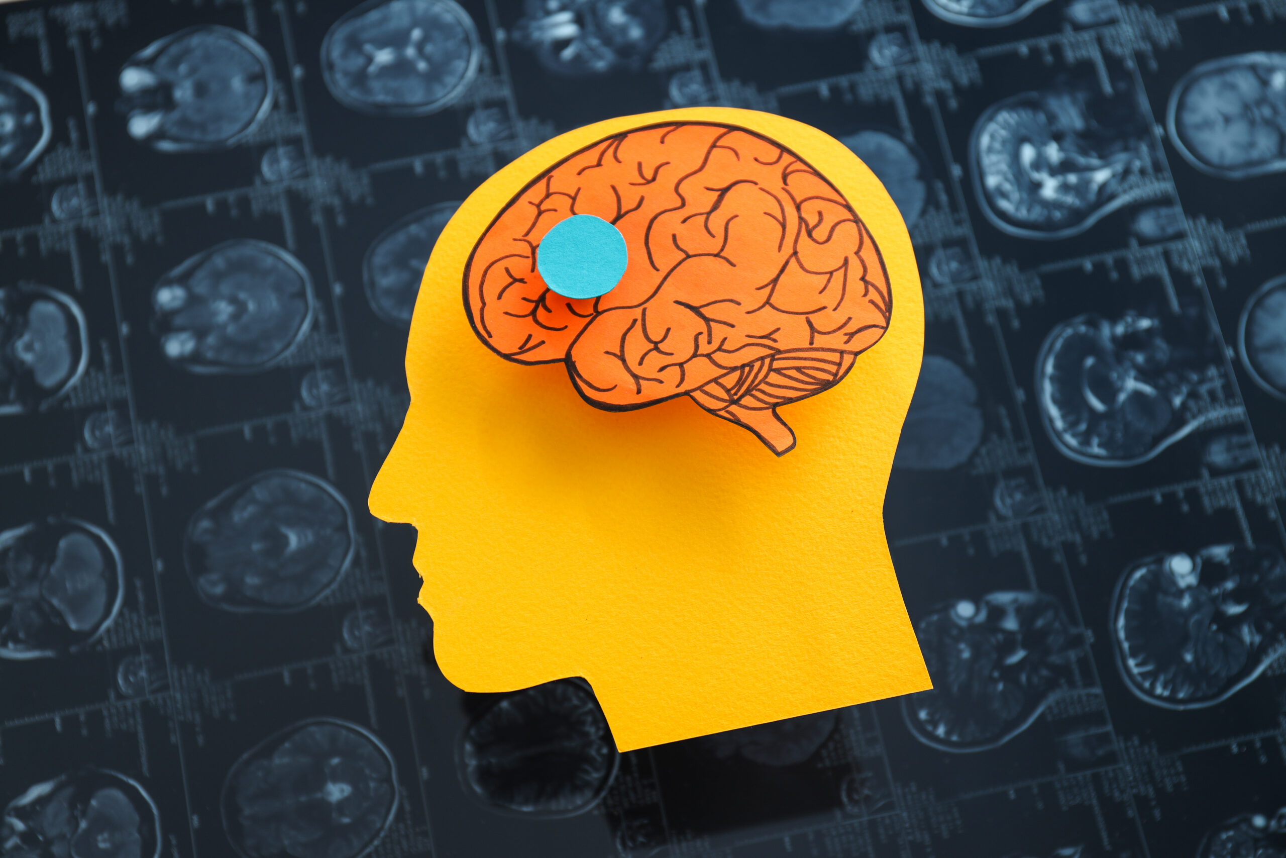 MRI images or magnetic resonance imaging with paper human head and brain.